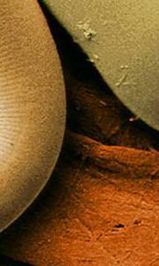 Les nématodes Les nématodes