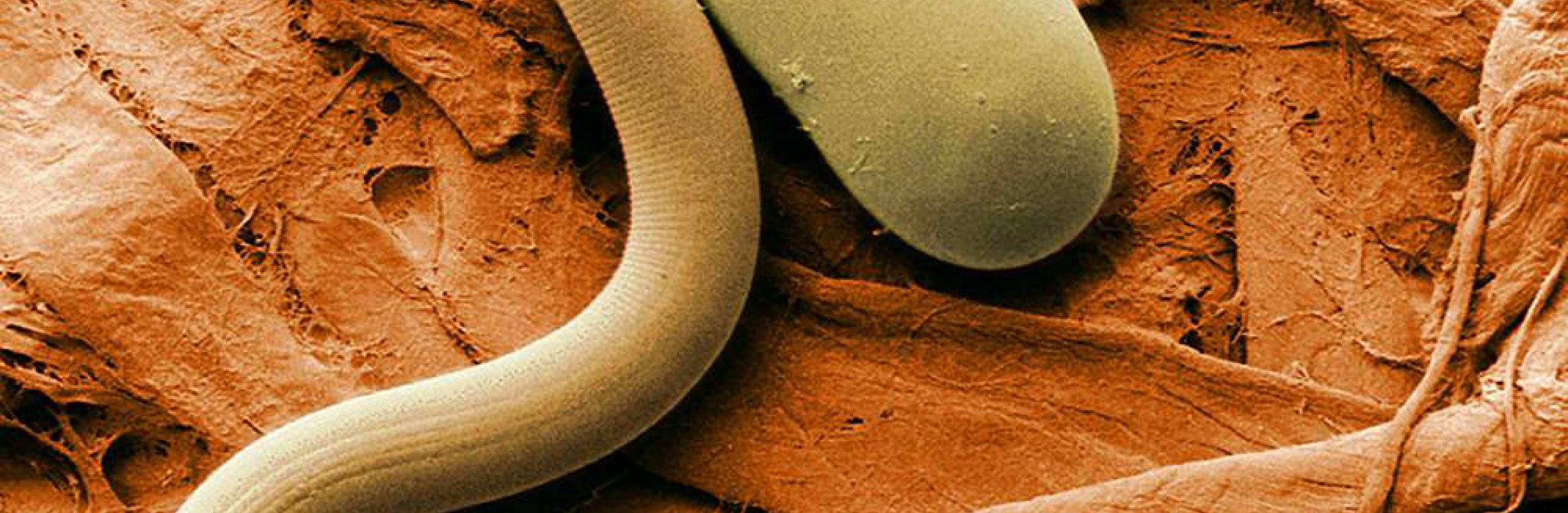 Les nématodes Les nématodes